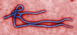 Colorized electron micrograph of Ebola virus particles