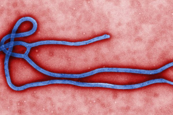 Colorized electron micrograph of Ebola virus particles